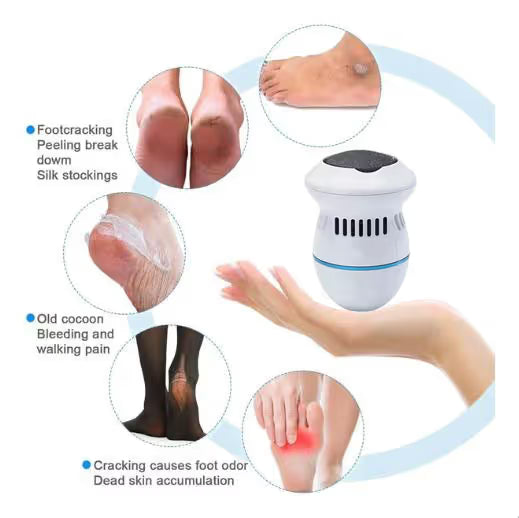 New Electric Foot Grinder