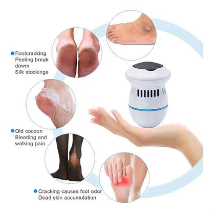 New Electric Foot Grinder